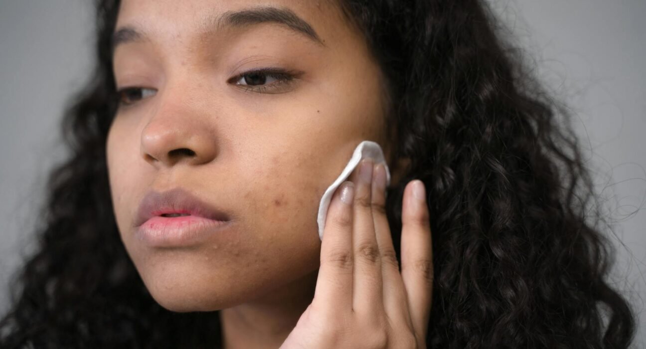 Adeus Cravos e Espinhas: O Guia Definitivo para uma Pele Radiante e Sem Imperfeições — como acabar com cravos e espinhas rapi